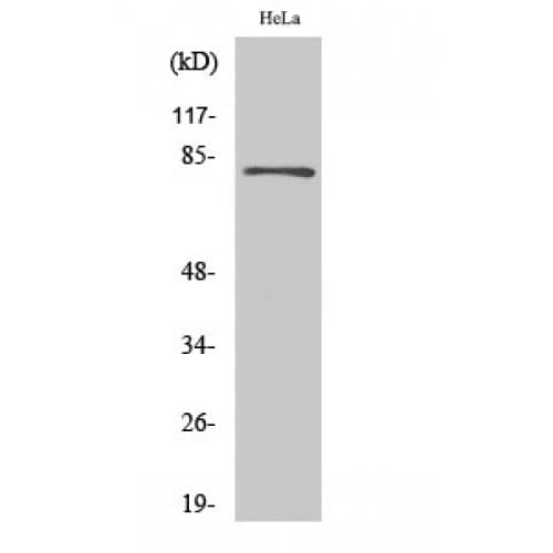 Polyclonal Rabbit anti-Human EPS8L2 Antibody (10-90 aa, N-terminal, IHC, IF, WB)