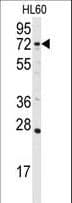 Polyclonal Rabbit anti-Human DGKA Antibody (aa598-628, IHC, WB)