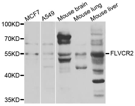 FLVCR2 Antibody