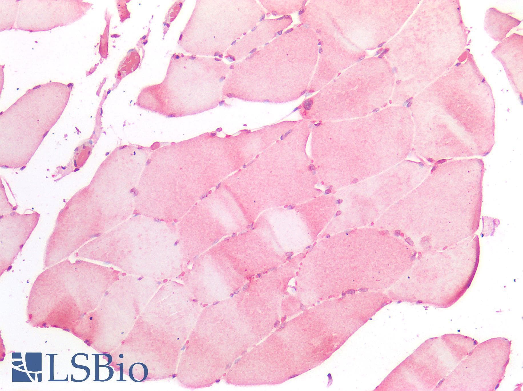 IHC-plus™ Polyclonal Rabbit anti-Human ATG16L1 / ATG16L Antibody (IHC)