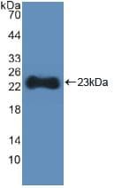 HMGCS1 / HMG-CoA Synthase 1 Antibody (aa293-467, PE)