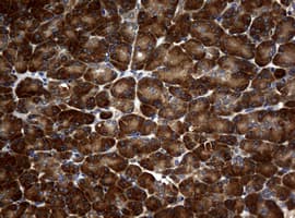 Monoclonal Mouse anti-Human NME1 / NM23 Antibody (clone OTI7F2, IHC, WB)