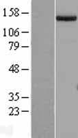 ESET / SETDB1 Protein (Over-Expression Lysate Myc-DDK (Flag))