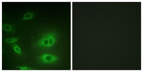 ATP1A1 Antibody (aa15-64)