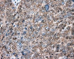Basigin / Emmprin / CD147 Antibody (clone OTI3E9)