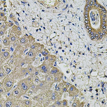 IHC-plus™ Polyclonal Rabbit anti-Human KCNK9 / TASK3 Antibody (IHC, WB)