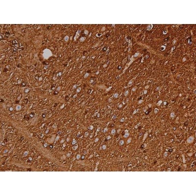 MAPT / Tau Antibody (phospho-Ser404)
