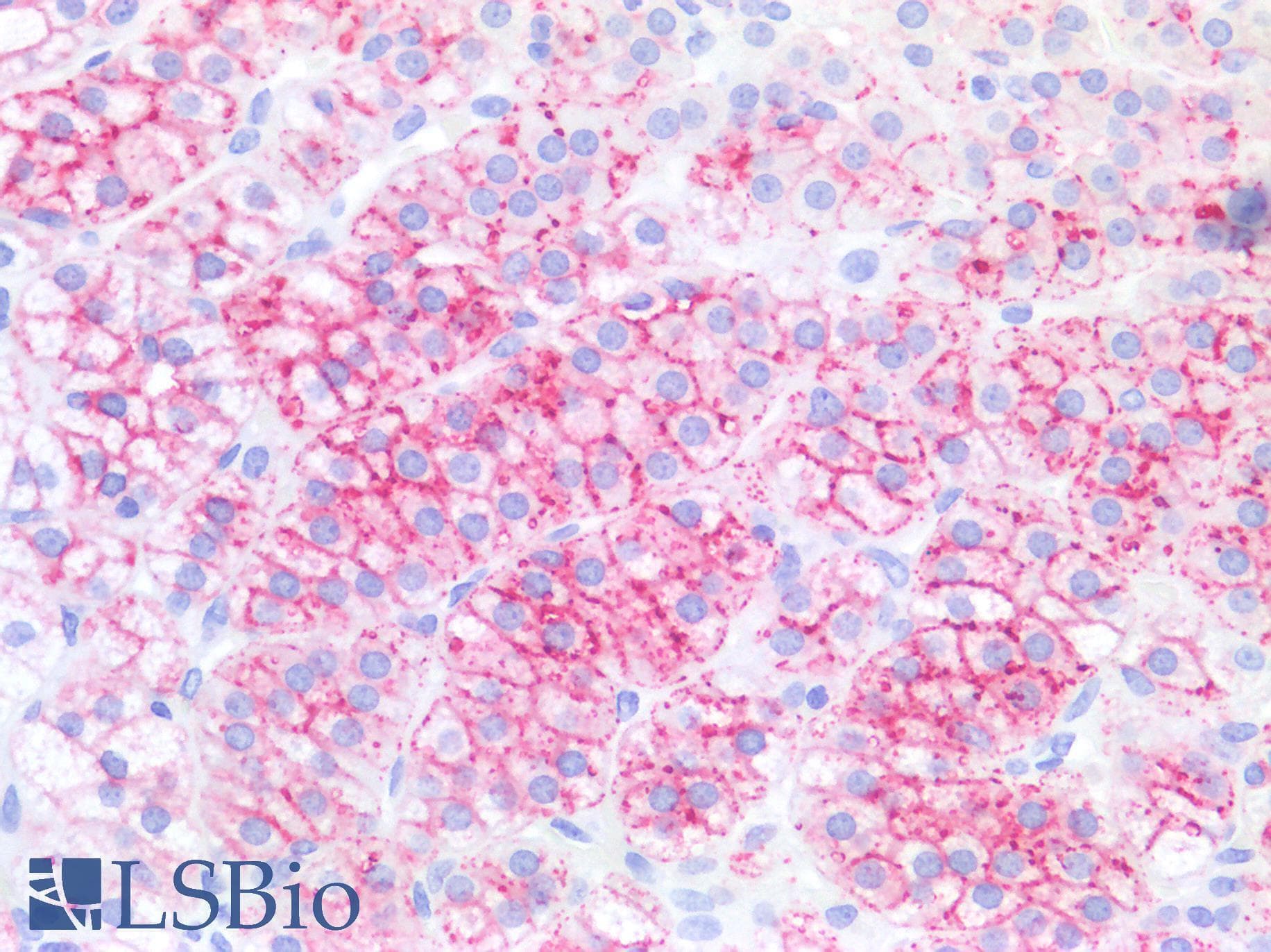 IHC-plus™ SCARB1 / SR-BI Antibody (clone OTI1F3)