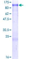 Human ZNF263 Protein (Recombinant GST)