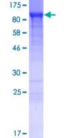 Human ANKRD50 Protein (Recombinant GST)