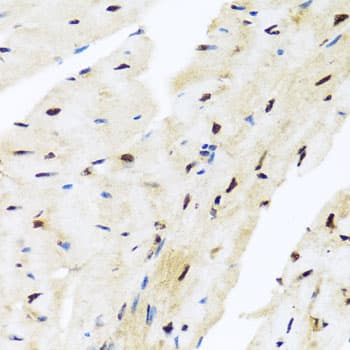 ZBTB17 / MIZ-1 Antibody