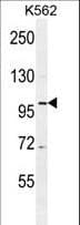 DDX27 Antibody (aa770-796)