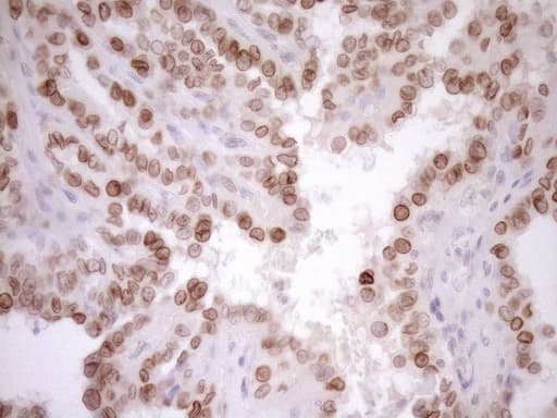 MED15 / ARC105 Antibody (aa393-679, clone OTI1C11)