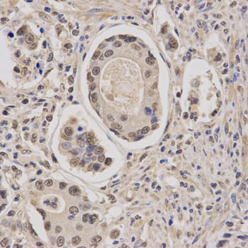 Polyclonal Rabbit anti-Human CBFB Antibody (IHC, IF, WB)