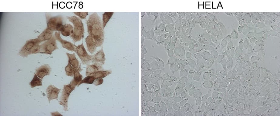 ROS1 / ROS Antibody (aa2126-2347, clone OTI7E4, Carrier-free)