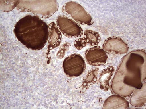 Monoclonal Mouse anti-Human TG / Thyroglobulin Antibody (clone OTI8B5, aa20-358, IHC)