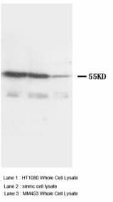 TNFRSF1A / TNFR1 Antibody (aa195-211)