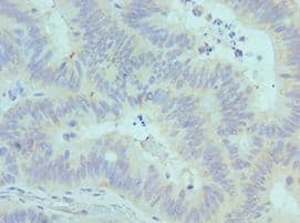 SYNCAM / CADM1 Antibody (aa45-344)