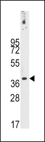 IHC-plus™ PDHX / Protein X / ProX Antibody (Thr11)
