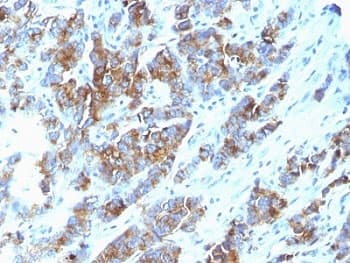 EMA / MUC1 Antibody (clone SPM533)
