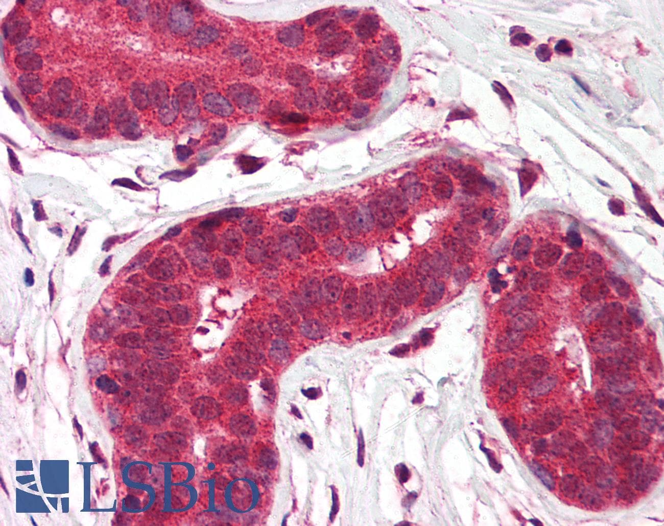 IHC-plus™ TMED10 / TMP21 Antibody