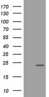 VILIP / VSNL1 Antibody (clone OTI5B10)