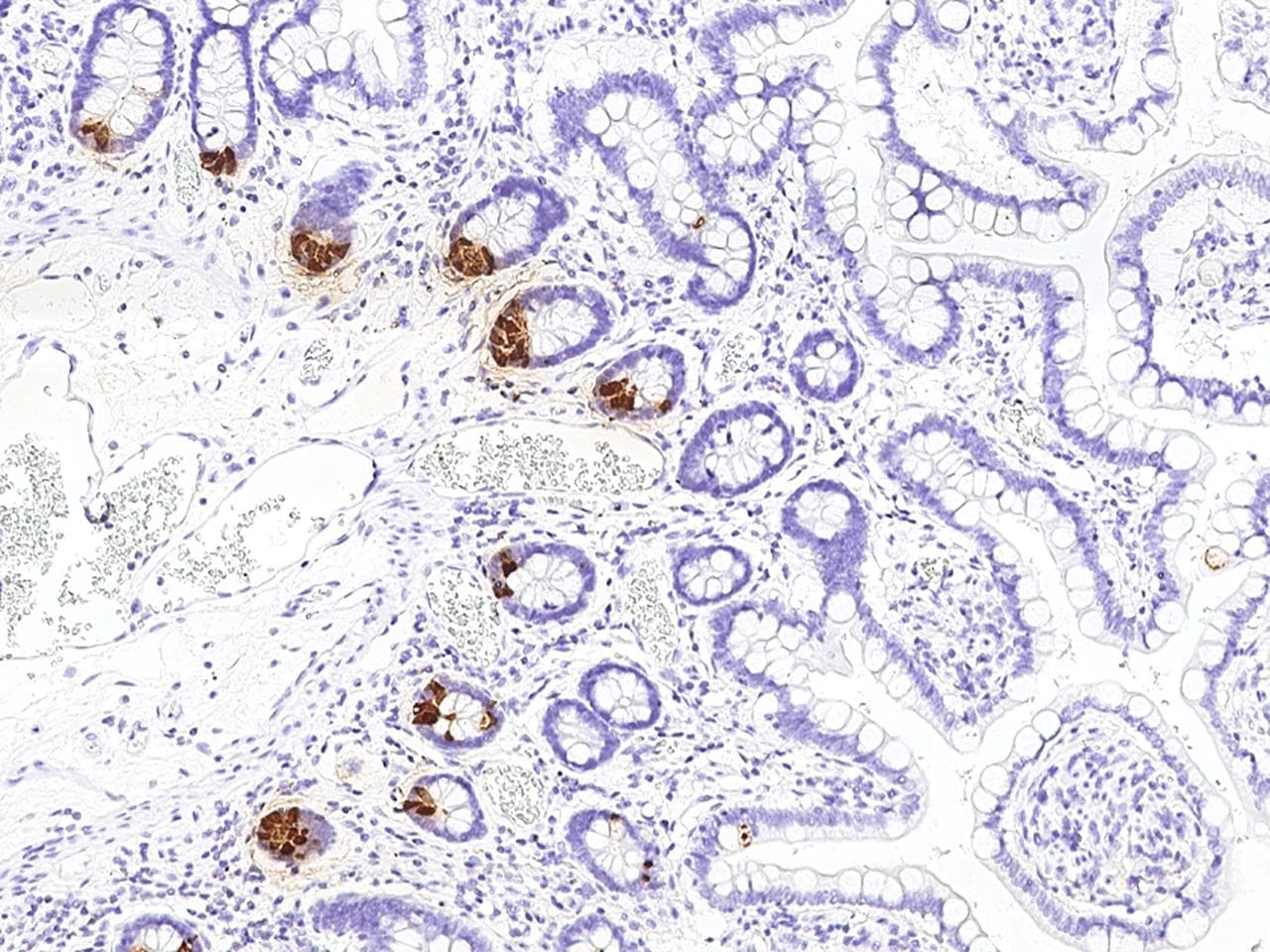 REG3A Antibody (Preservative Free)