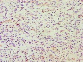 Polyclonal Rabbit anti-Human DDX5 Antibody (aa1-290, IHC, WB)