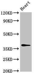 MAT2B Antibody