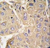 PTPN7 / HEPTP Antibody (Ser44)