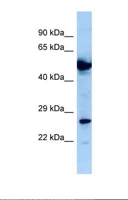 ALS2CR1 / NIF3L1 Antibody (aa179-228)