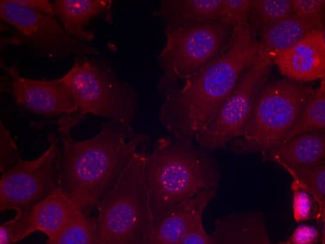 Polyclonal Rabbit anti-Human ER Alpha / Estrogen Receptor Antibody (phospho-Ser167, IHC, IF, WB)