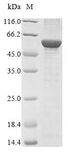 Bovine FDXR Protein (Recombinant 10His, N-terminus)