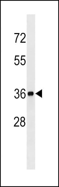 BLVRA Antibody (aa61-89)