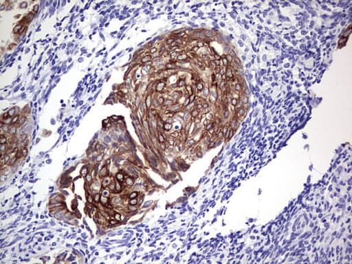 Monoclonal Mouse anti-Human KRT19 / CK19 / Cytokeratin 19 Antibody (clone OTI5F4, aa240-390, IHC, WB)