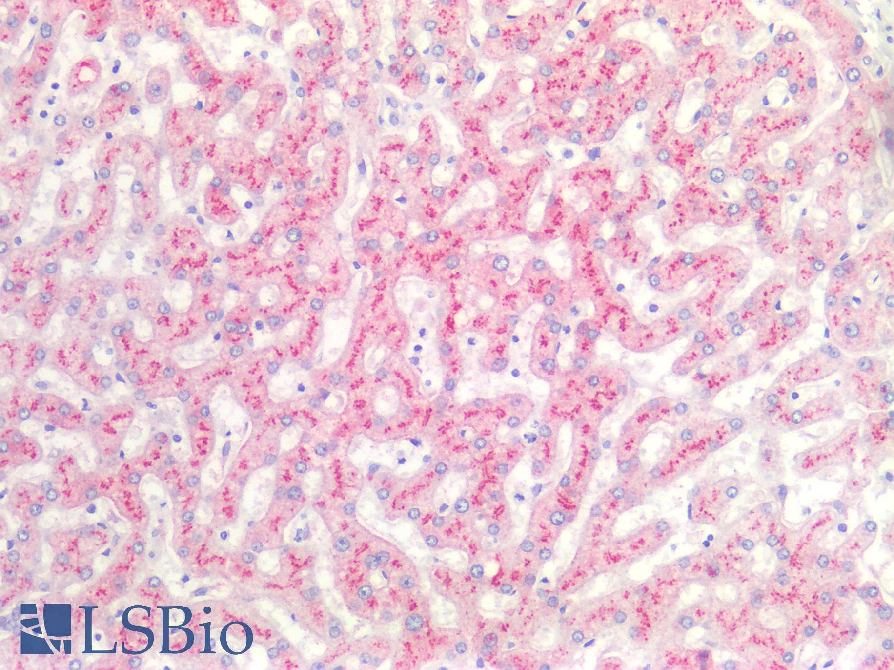 SAA1 / SAA / Serum Amyloid A Antibody