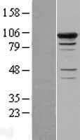 SMEK1 Protein (Over-Expression Lysate Myc-DDK (Flag))