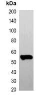 DYKDDDDK Tag Antibody