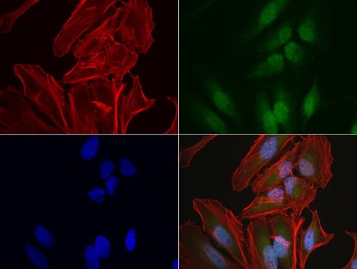 C14orf166 Antibody (clone UMAB182)