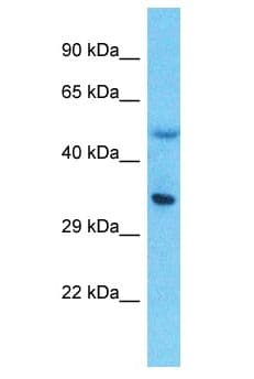 LPPR5 Antibody (aa2-51)