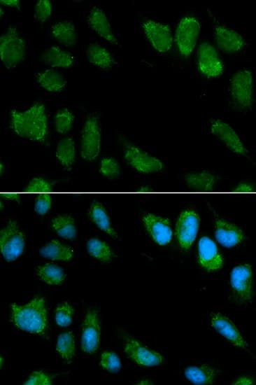 IHC-plus™ IL1RN Antibody