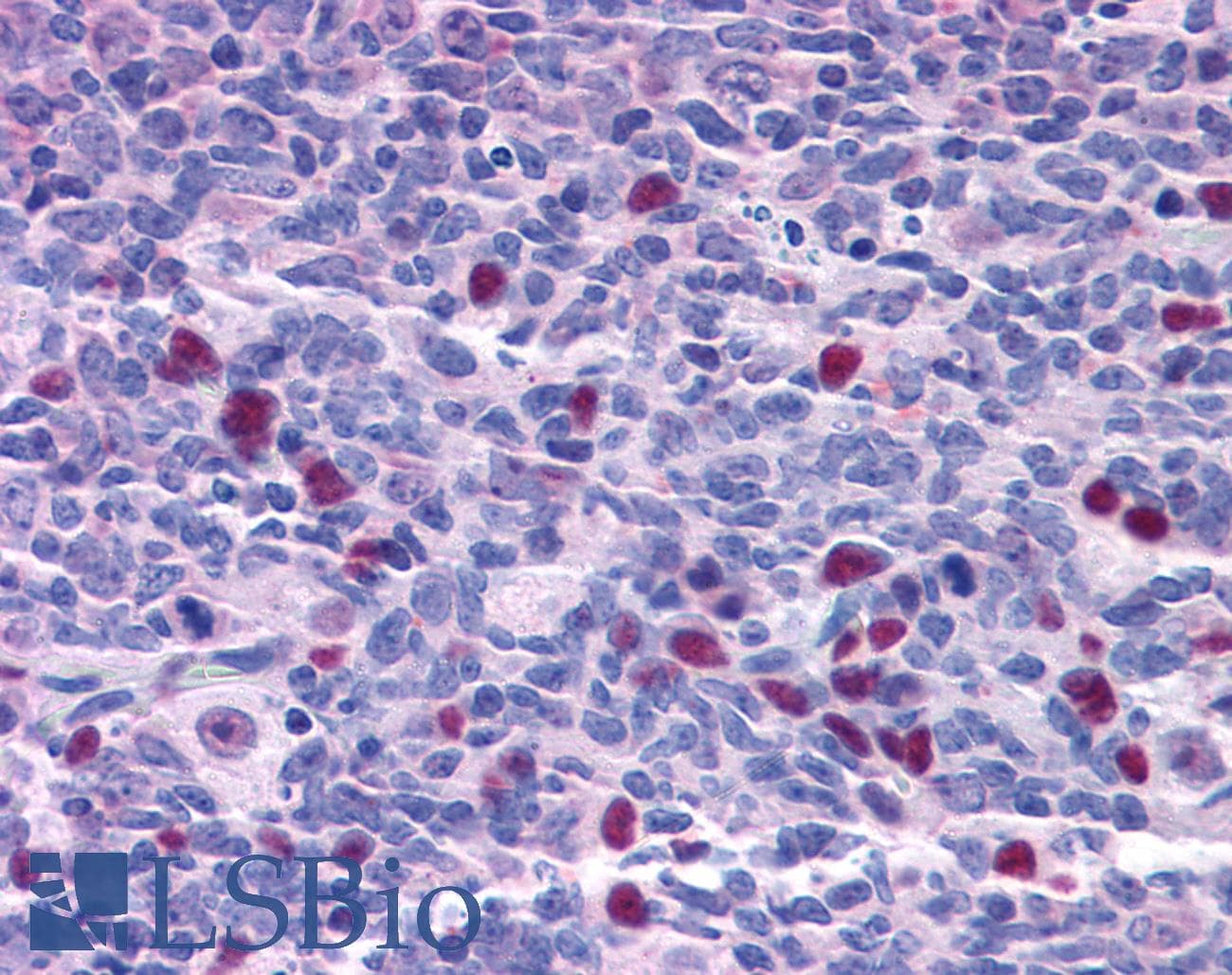 IHC-plus™ NAT10 Antibody (aa917-928)