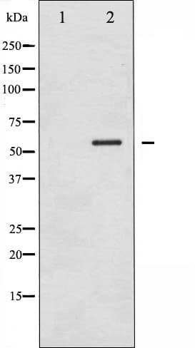 CAMK4 / CaMK IV Antibody (phospho-Thr196,pThr200)