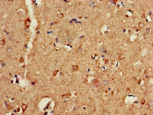 P2RX1 / P2X1 Antibody