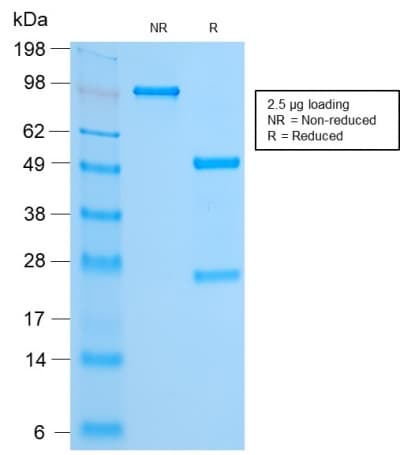 FOXA1 Antibody (aa372-472, clone FOXA1/2230R)