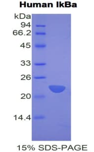 Human NFKBIA / IKB Alpha / IKBA Protein (Recombinant His)