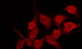 TP53 / p53 Antibody (phospho-Ser20)