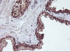 HDHD1 Antibody (clone OTI7A2)