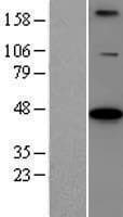 BCS1L Protein (Over-Expression Lysate Myc-DDK (Flag))