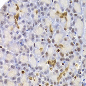 PARD6A / PAR6 Antibody